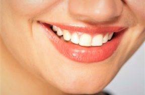 L’implant dentaire la solution de remplacement des dents en manque